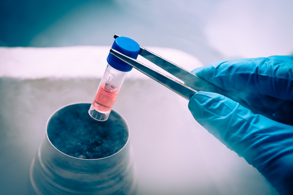 ヒト幹細胞培養上清液